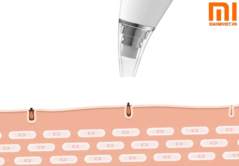 máy hút mụn đầu đen xiaomi