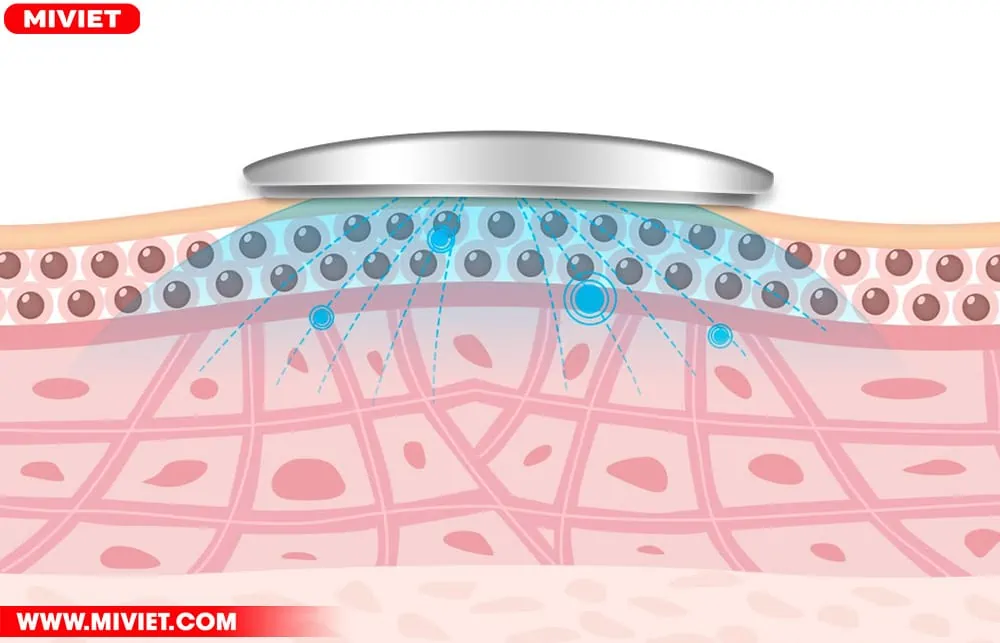 2 điện cực tạo ra xung điện với tần số thấp