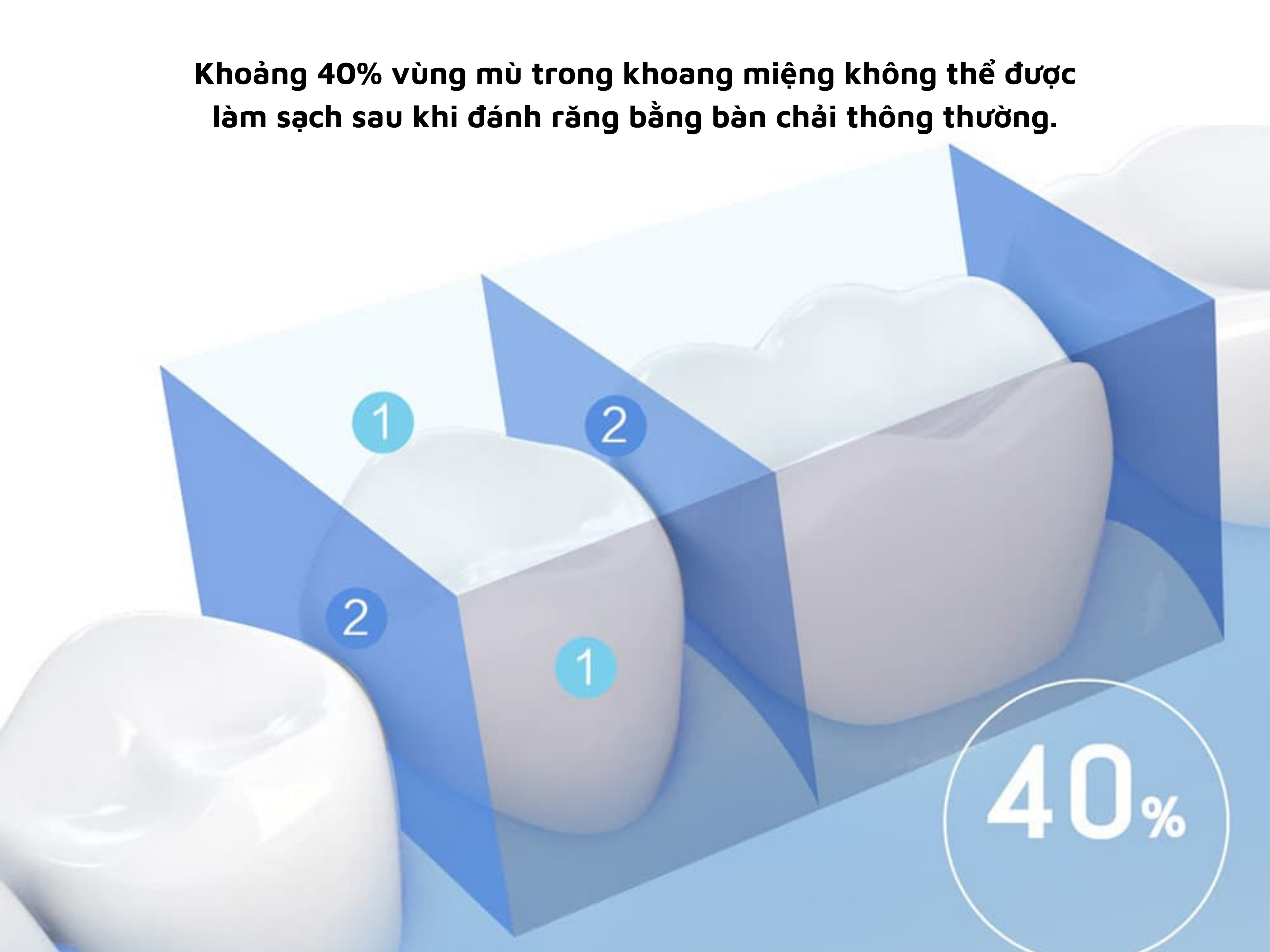 Tăm nước Xiaomi Soocas W3 Pro Chính Hãng Khoảng 40% vùng trong khoang miệng không thể được làm sạch bằng đánh răng thông thường