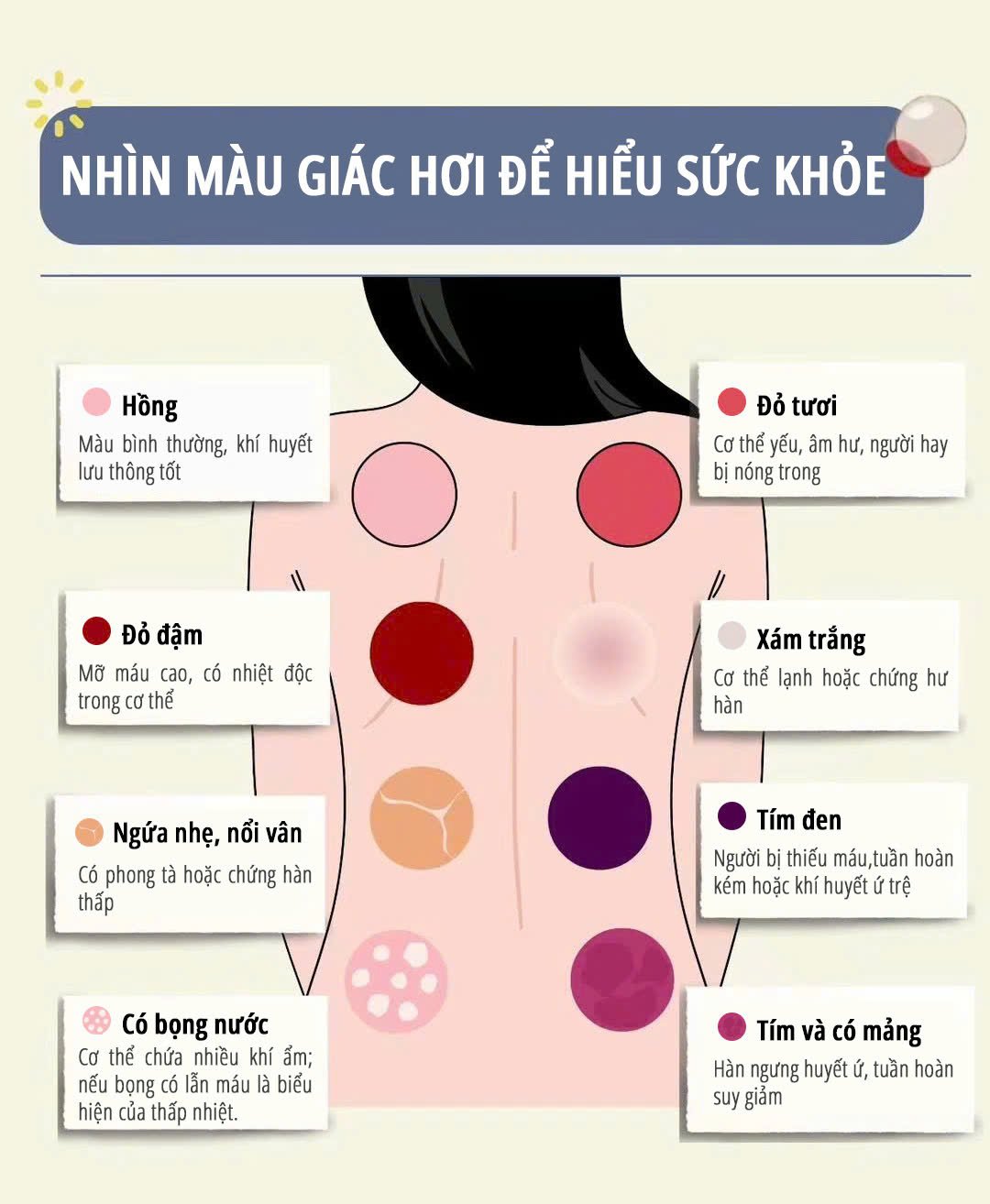 Máy giác hơi điện cầm tay miLife C1 nhìn màu giác hơi hiểu sức khỏe